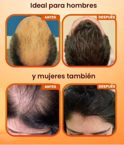 BATANA OIL: FÓRMULA ORIGINAL