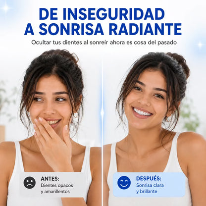 MY SMILE: Kit de Blanqueamiento Dental con Luz LED