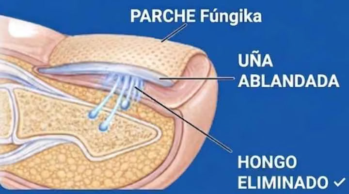 Cómo eliminar el hongo de raíz